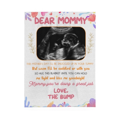 Personalized First Mother's Day Blanket, Custom Photo Sonogram Blanket, Baby Shower Gift for Newborn, Mother's Day Gift for Pregnant Mom/Wife/Daughter